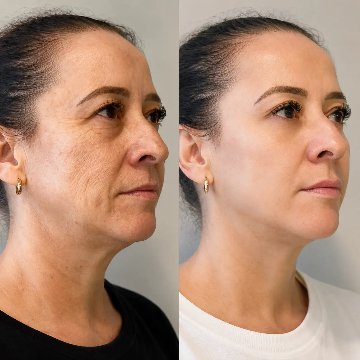 FaceSculpta Facial Massager