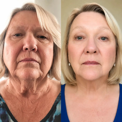 FaceSculpta Facial Massager